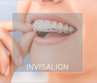 invisalign