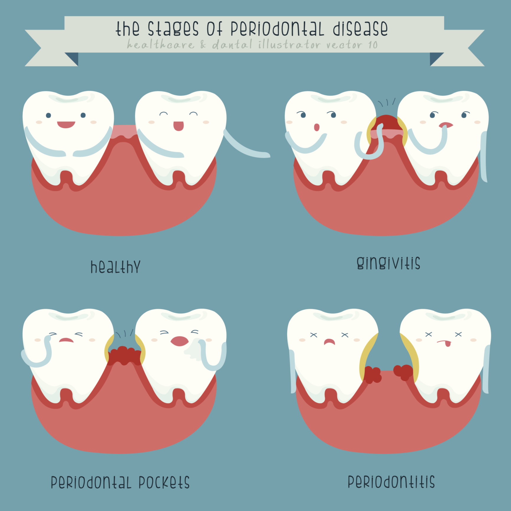 The Three Stages of Gum Disease | Kenilworth Dentist | Village Dental